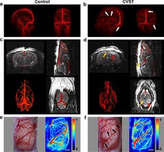 A novel rat model for cerebral venous sinus thrombosis: verification ...