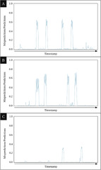 Anomaly detection in microservice environments using distributed ...