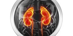 Kidney failure (renal failure with uraemia, or azotaemia)