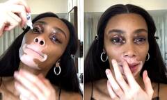 Winnie Harlow reveals she uses EYE DROPS on the white vitiligo ...