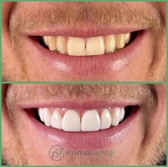 Primo Dental UK | Dentistry | Best Dental Treatment Provider