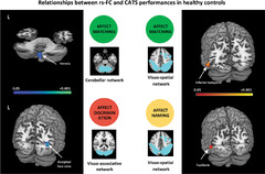 Resting state functional brain networks associated with emotion ...