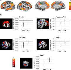 Mapping the effects of pregnancy on resting state brain activity ...