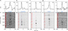 A repeating fast radio burst source in a globular cluster | Nature