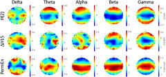 Multifractal and entropy analysis of resting-state ...