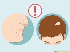 How to Apply Testosterone Cream: 9 Steps (with ) - wikiHow