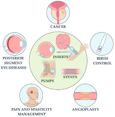 Bioengineering |-Text | Implantable Drug Delivery ...