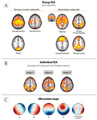 Bioengineering |-Text | Self-Regulation of Attention in ...