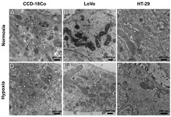 Cells |-Text | Quantitative Phase Imaging Detecting the ...