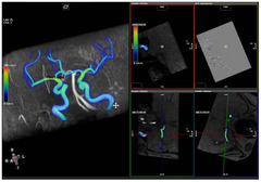 Diagnostics |-Text | Intracranial Flow Velocity ...