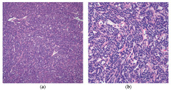 Diagnostics |-Text | Thymoma: An Overview