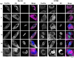 The AKT Forkhead box O transcription factor axis regulates human ...