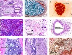 Frontiers | Using Advanced Cell Culture Techniques to ...