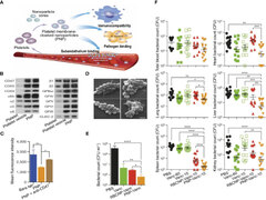 Cell-membrane-coated nanoparticles for the fight against pathogenic bacteria, toxins, and inflammat