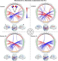 Frontiers | EEG Microstate-Specific Functional Connectivity and ...