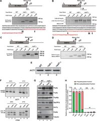 Polyadenylated%20versions%20of%20small%20non-coding%20RNAs%20in%20Saccharomyces%20...