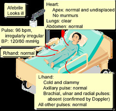 Upper Limb Ischemia, Acute - Interactive case study | Clinical ...