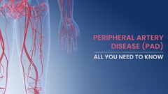 Peripheralery Disease (PAD): Symptoms, Stages, Risk Factors ...