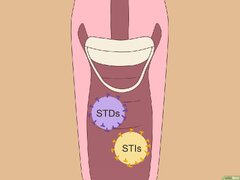 How to Use the Birth Control Sponge - wikiHow